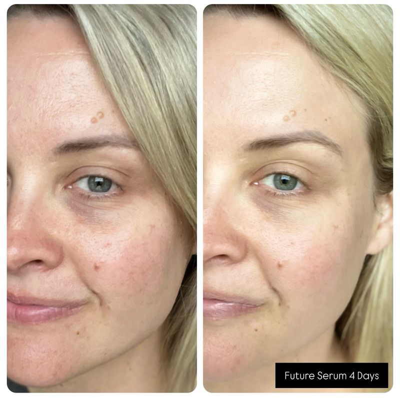 Future Serum