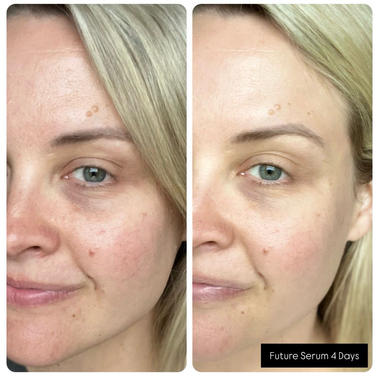 Future Serum