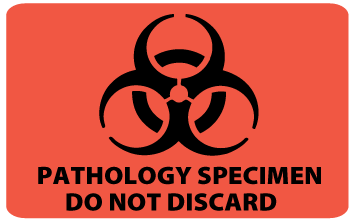 Pathology Specimen Do Not Discard