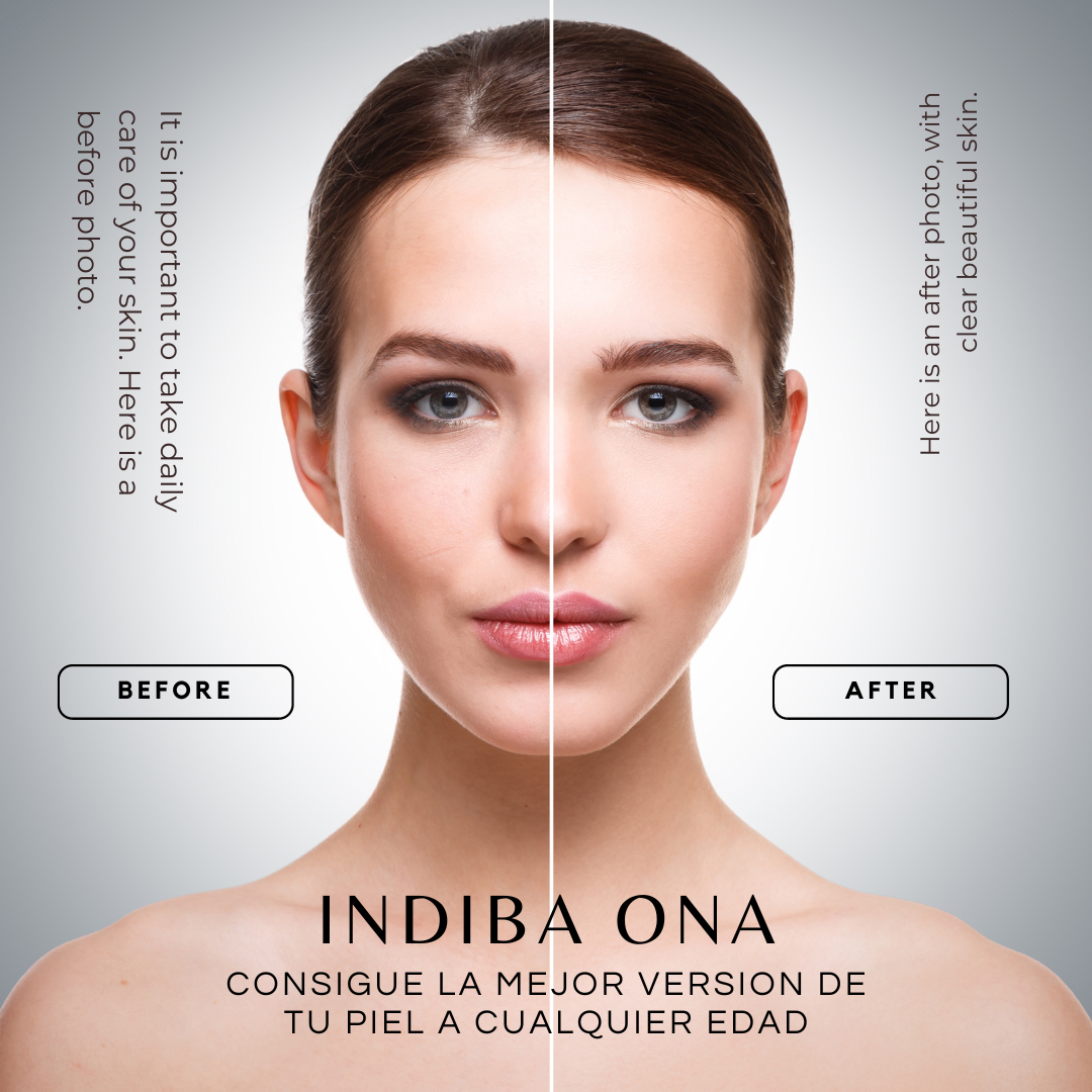 INDIBA ONA