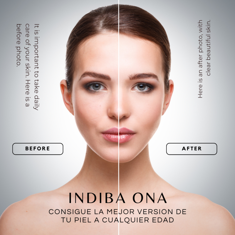INDIBA ONA