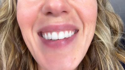 Beginning of the End