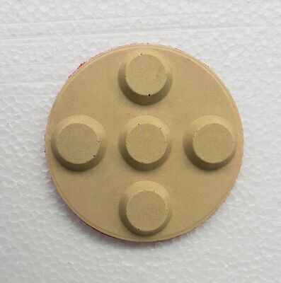 SEGMENTO DIAMANTADO RODO AMARILLO DE 400 GRAMOS SEGMENTO DIAMANTADO RODO AMARILLO DE 400 GRAMOS