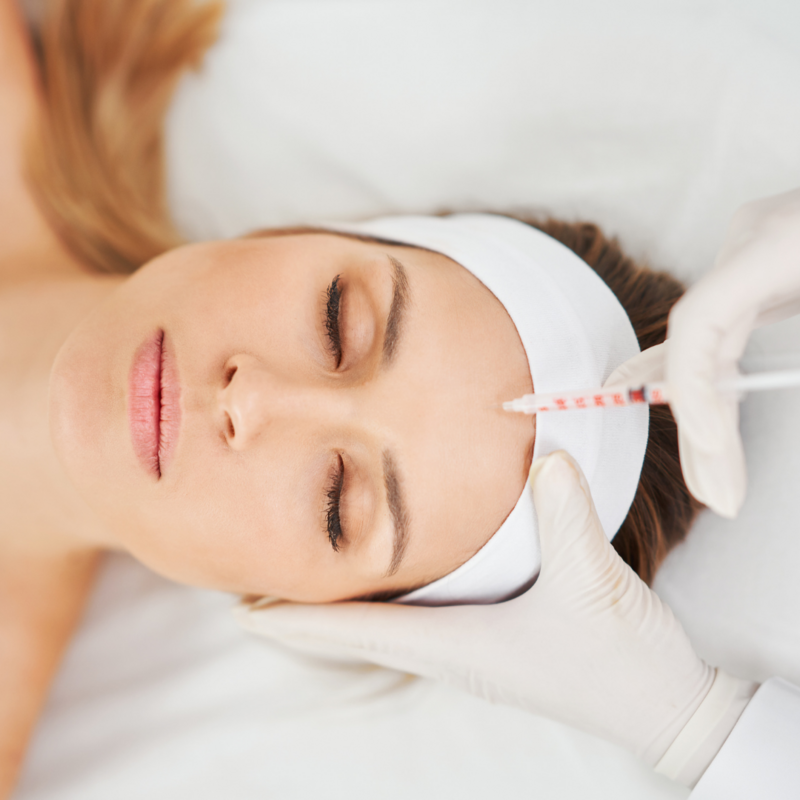 Neuromodulación de arrugas de expresión