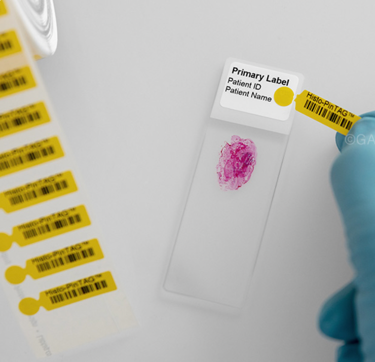 Histo-PinTAG™ - Removable Thermal-Transfer Labels for Microscope Slide Re-Identification (Patent Pending)