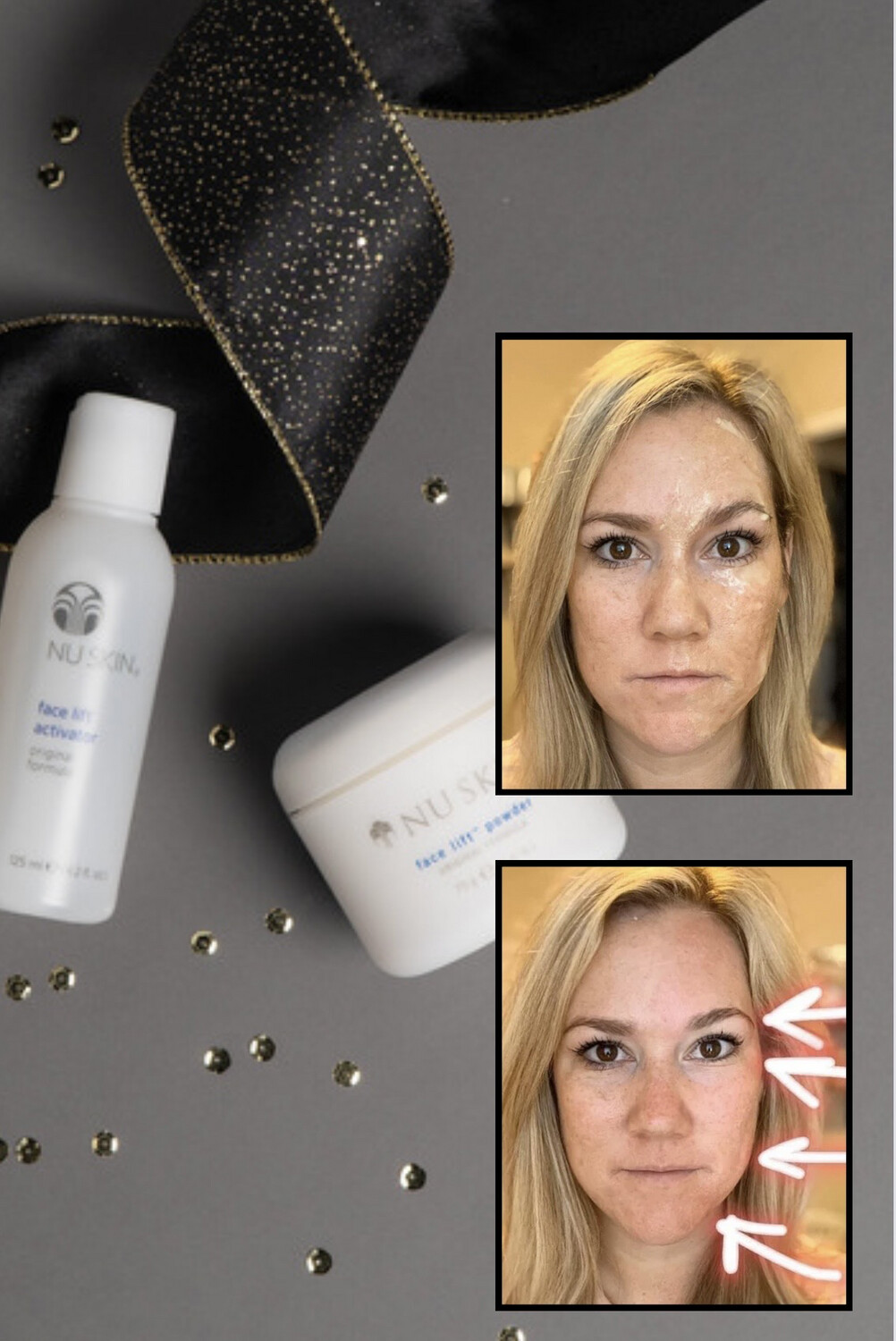 Face lift Kit (Powder W/ Activator)