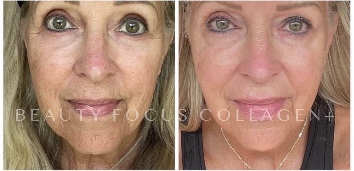 Liquid Collagen (Box Of 30 Packets)