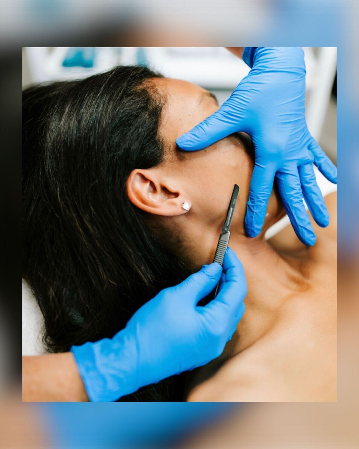 U-nique Dermaplaning ONLINE KURSUS inkl. opstartskit
