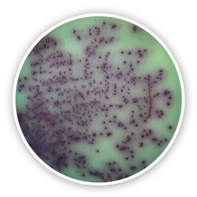 Chromogener Pseudomonas-Agar