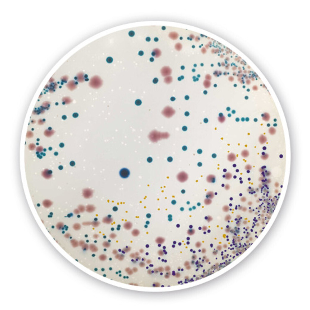 Agar cromogenico UTI