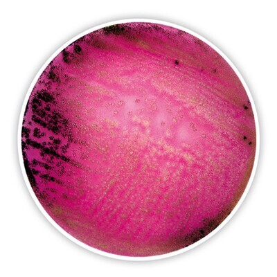 Bengalrot-Agar (mit Chloramphenicol)