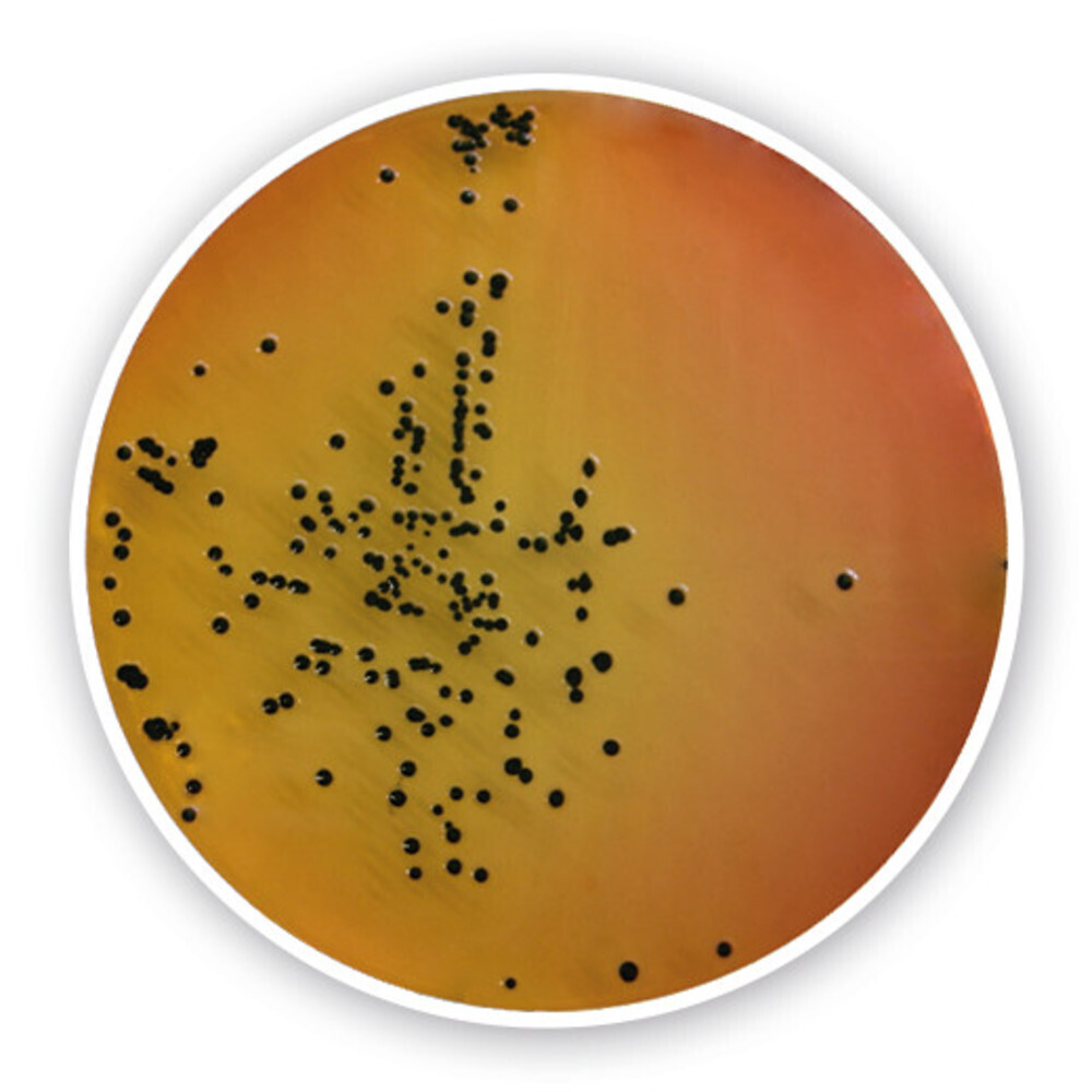 Salmonella-Shigella Agar