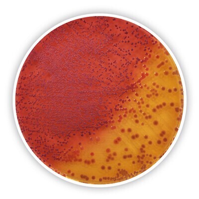 Agar selectivo Yersinia (base)