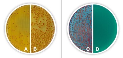 TTC Chapman Agar (with sodium heptadecylsulphate) (Base)