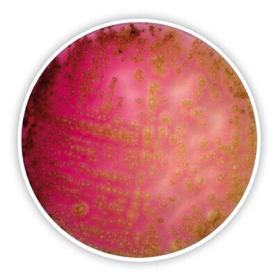 Gélose au rouge de Bengale au dichlorane (avec chloroamphénicol)