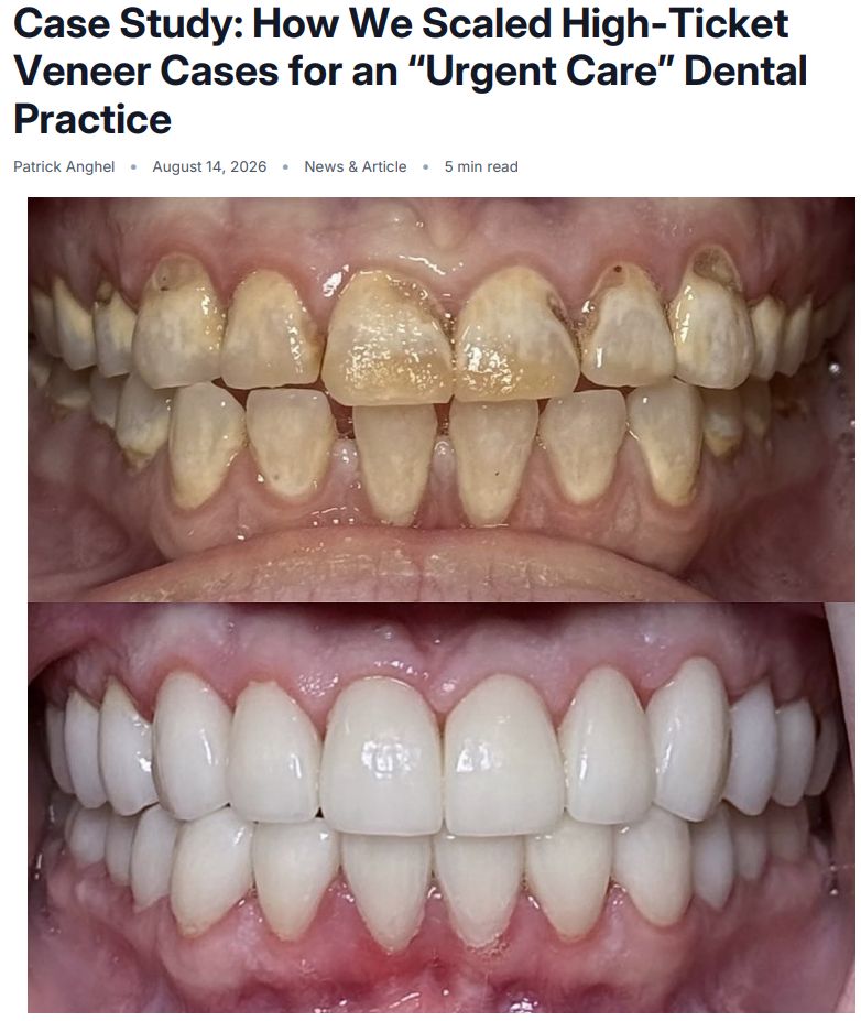 FREE Case Study: How We Scaled High-Ticket Veneer Cases