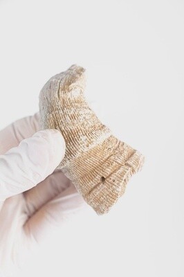 418 Million Year Old Horn Coral Fossil