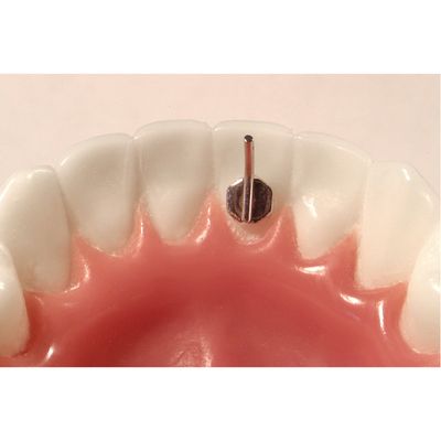 LINGUAL TONGUE DIRECTOR 7.5mm ( 10pcs Box ) - AMERICAN ORTHODONTICS