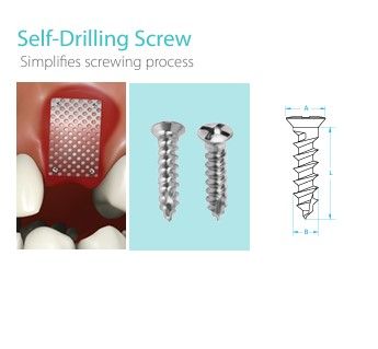 BONE SCREW 1pc/PACK - JEIL KOREA