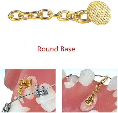 ERUPTION APPLIANCE GOLD CHAIN ( ROUND ) 10pcs /Pack - ORTHO UNION