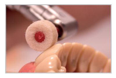 FELT POLISHING BURS 12pcs Kit - DIA SWIZZ