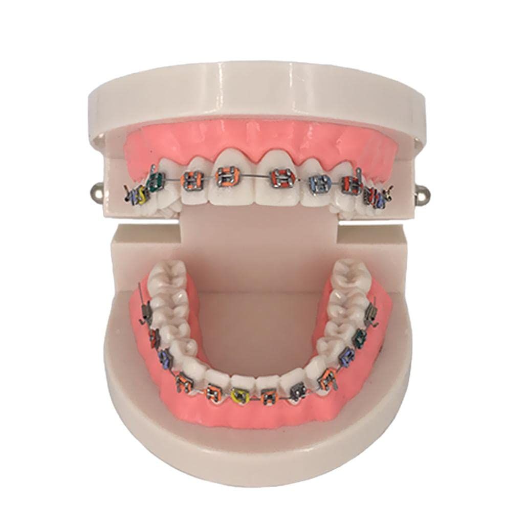 DENTAL TEETH STUDY MODEL ( ORTHODONTIC )