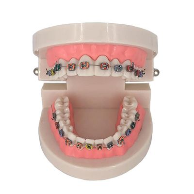 DENTAL TEETH STUDY MODEL ( ORTHODONTIC )