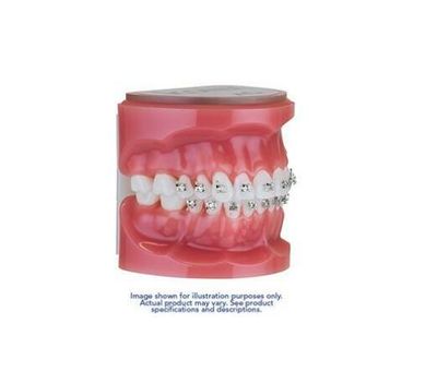 DENTAL TEETH STUDY MODEL ( ORTHODONTIC - BRACKETS- ICONIX ) - AMERICAN ORTHODONTICS