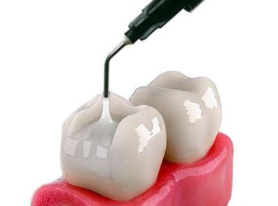 BULK FILL FLOWABLE COMPOSITES