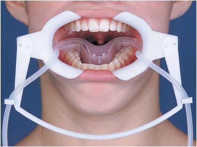 CHEEK RETRACTOR NOLA ( DRY FIELD SYSTEM TUBING )