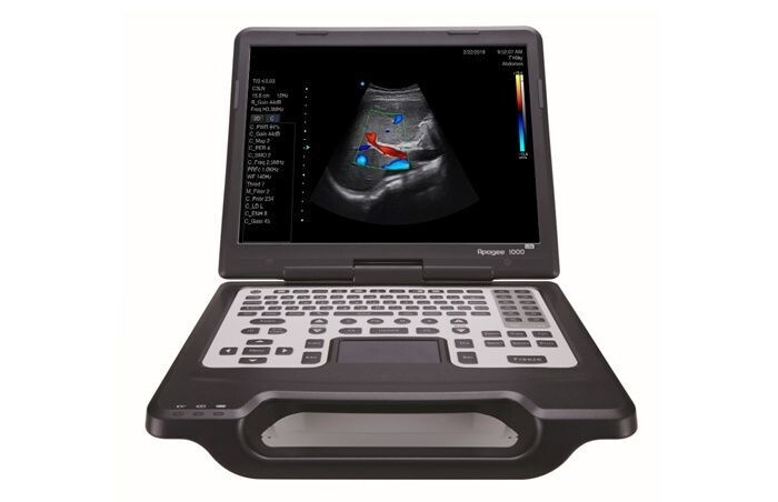SIUI Apogee 1000 lite portable ultrasound scanner