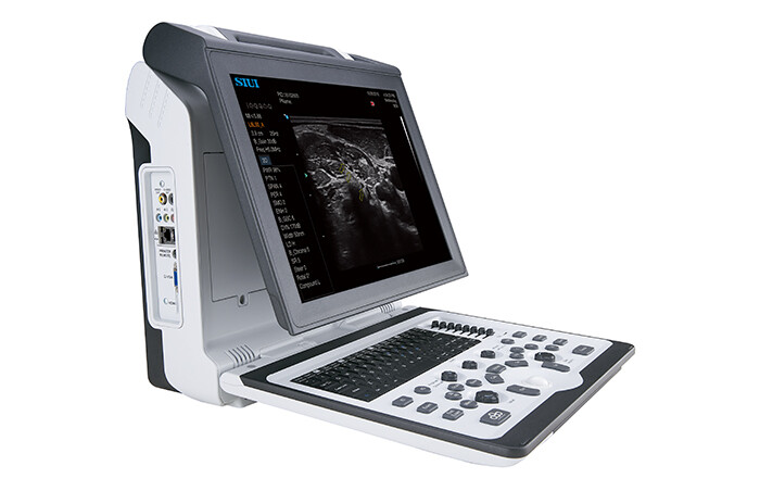 Apogee 2300 ultrasound scanner
