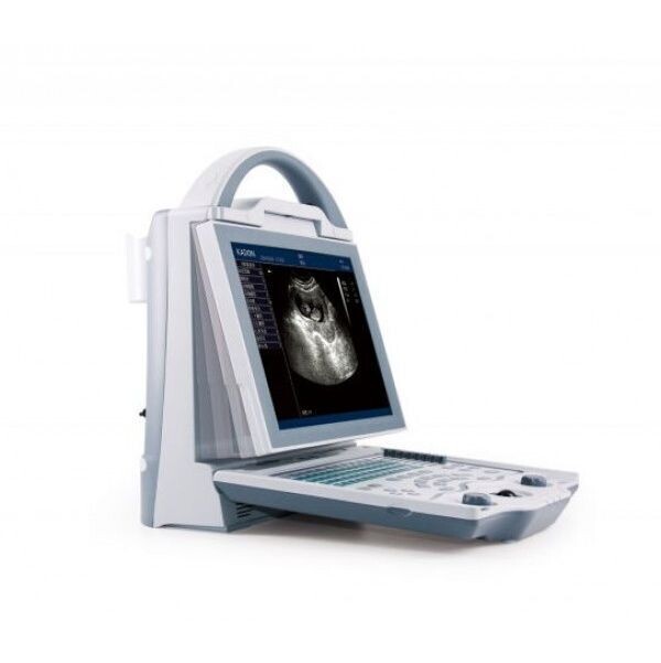 KX5600v Ultrasound Scanner KX5600v Ultrasound Scanner