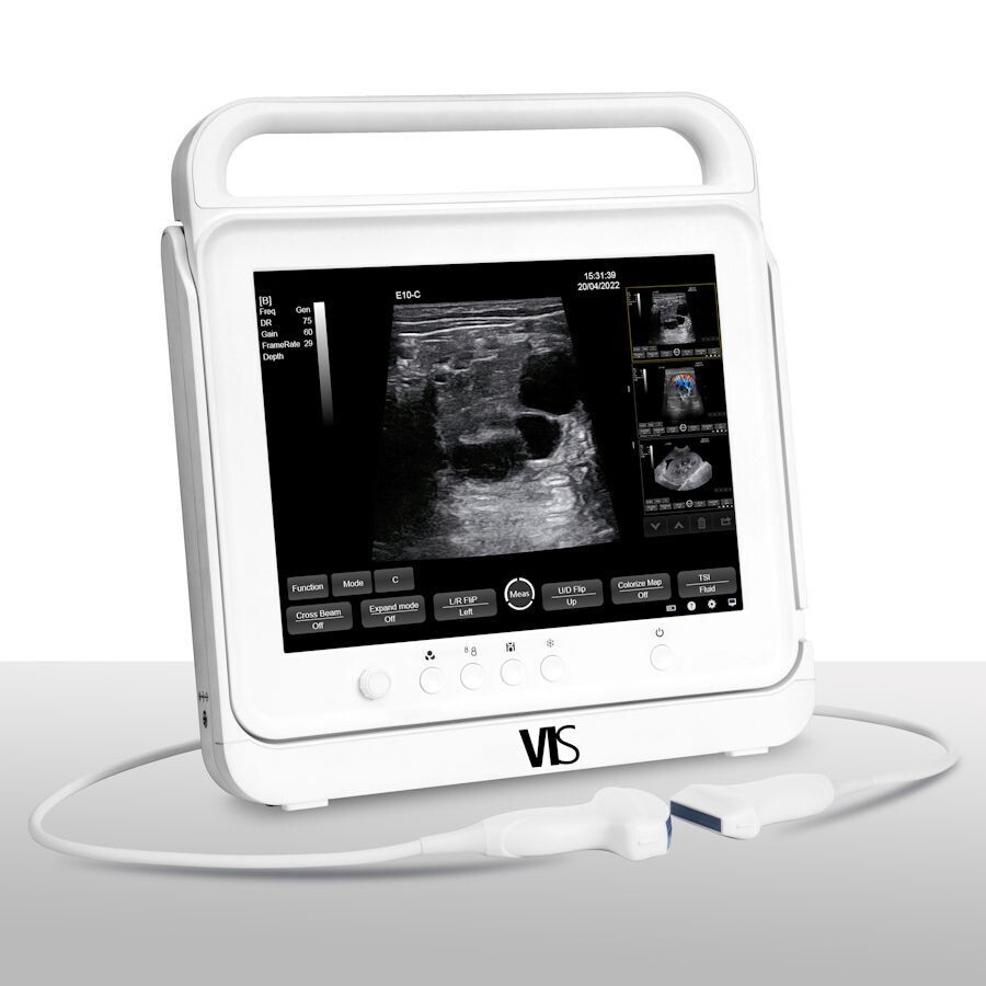 VIS V2 ScanPad Plus
