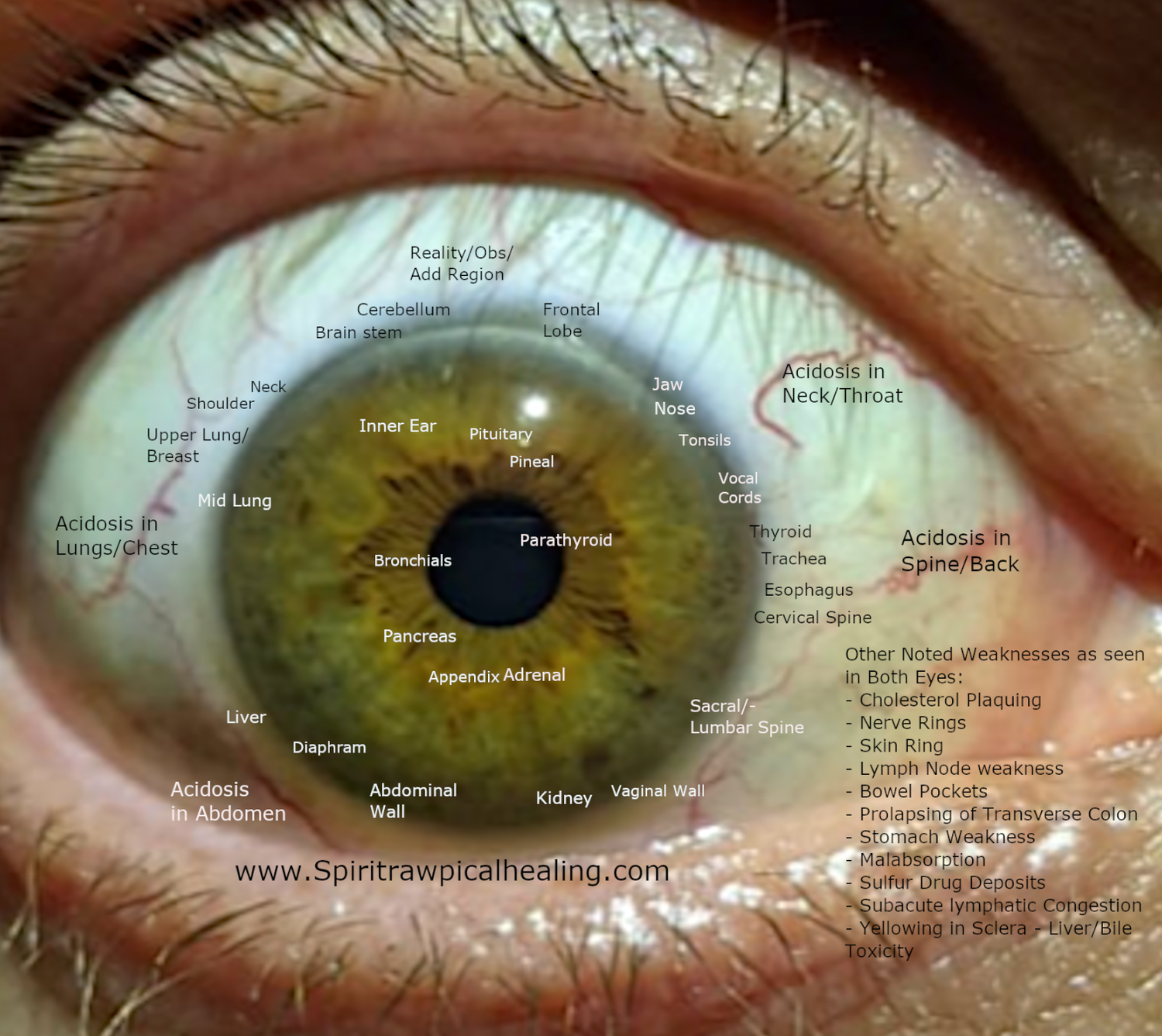 Iridology Reading and Herbal Protocol