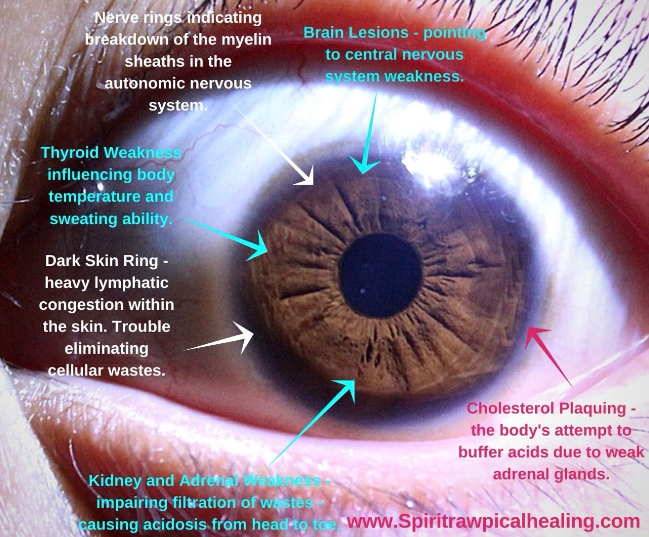 Iridology Reading