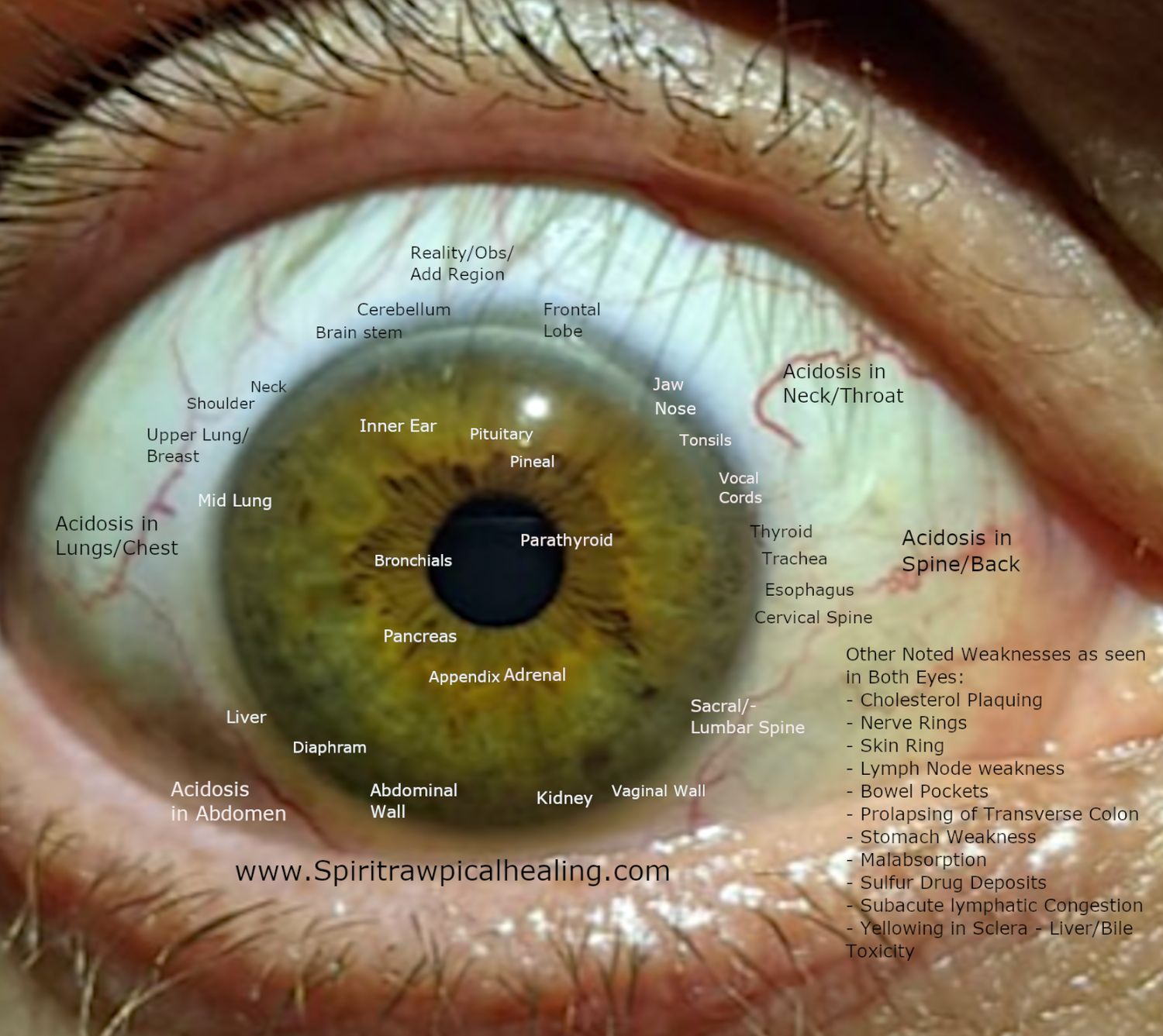 Iridology Reading + Herbal Protocol