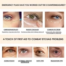 Fast Remove Fat Granule Eye Cream Particles Fat-removing Firm Anti Wrinkle Serum Improve Eyes Bag Puffy Anti-Aging Korean Care
