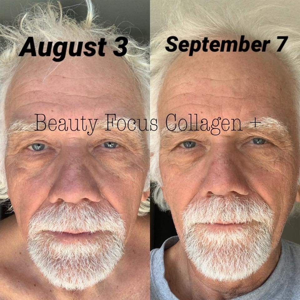 Facial Spa AKA wrinkle iron