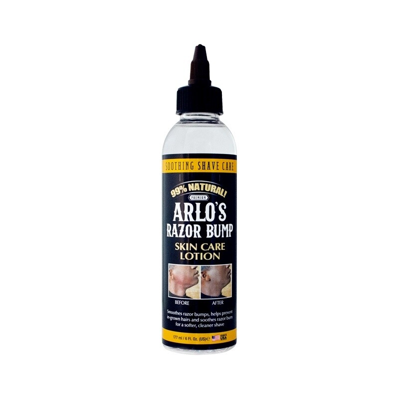 Arlos - Razor Bump - Skin Care Lotion