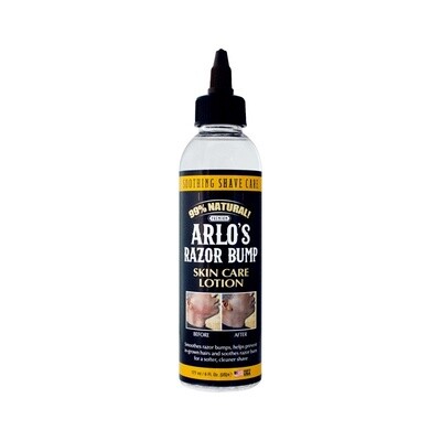 Arlos - Razor Bump - Skin Care Lotion