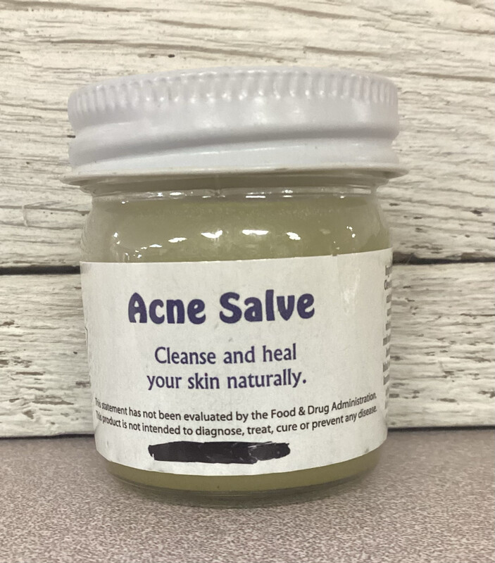1 OZ Acne