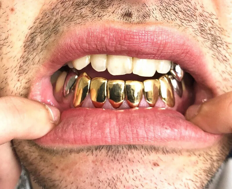 Solid 10kt Gold/.925s Permanent Cut Grillz