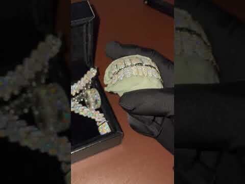 Vvs1 Mois Zigzag Iced Out Grillz (Single Set)