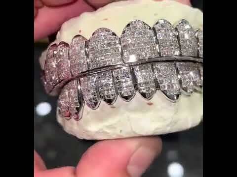 Vvs1 Moissanite Invisible Set Grillz (Single Set)