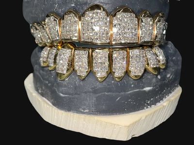 Vvs1 Moissanite Top &amp; Bottom Invisible Grillz Set