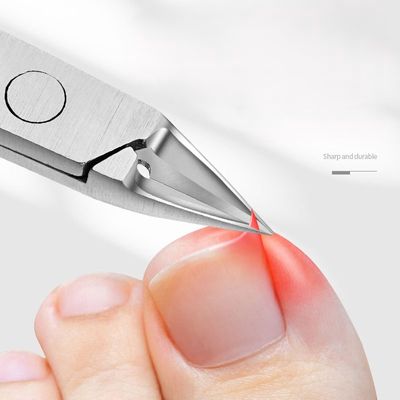 Nippers for Ingrown Nails