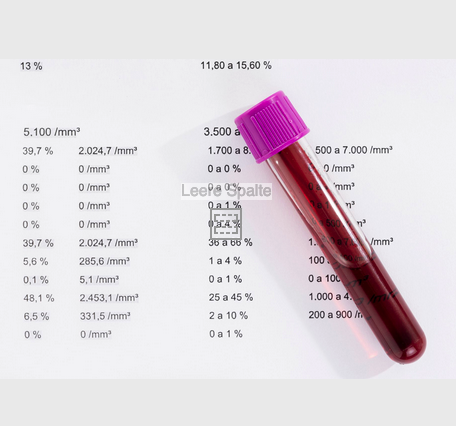 7-Blut- und Urin-Analyse