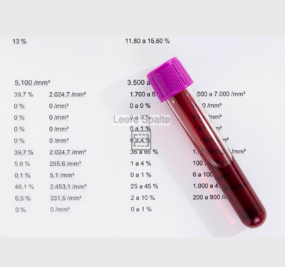 5-Blut- und Urin-Analyse
