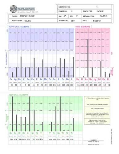 Trace Elements Inc. Profile 1